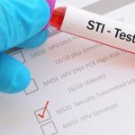 Why STI Tests Are Essential In This Day & Age.