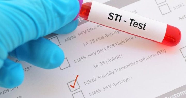 sexually transmitted infections Tests